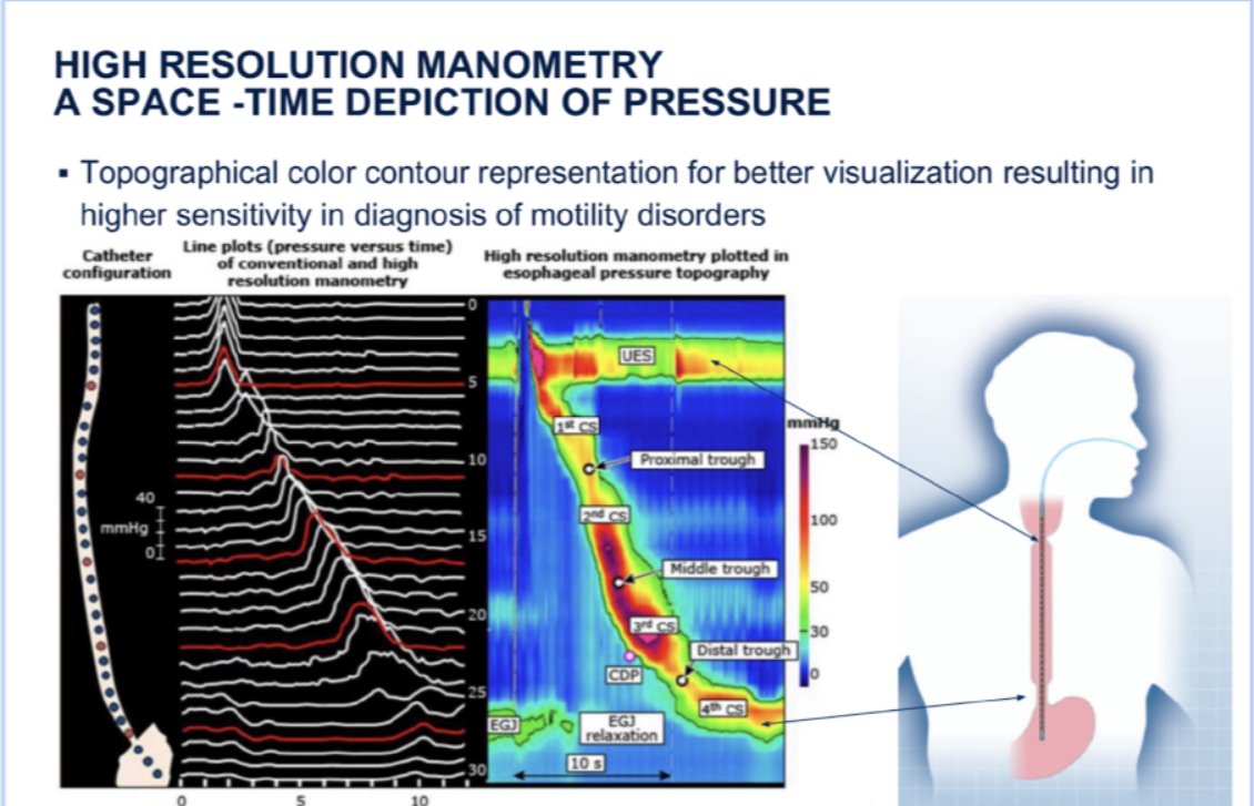 Understanding Esophageal Manometry: Insights, Functioning