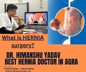 Doctor explaining hernia surgery.