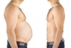 "Side-by-side comparison showing a person before and after weight loss, highlighting the transformation in body shape and overall appearance."